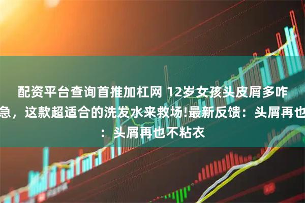 配资平台查询首推加杠网 12岁女孩头皮屑多咋办？别急，这款超适合的洗发水来救场!最新反馈：头屑再也不粘衣